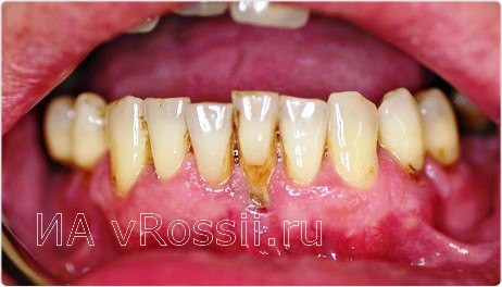 Ферментация листьев малины в домашних условиях 464