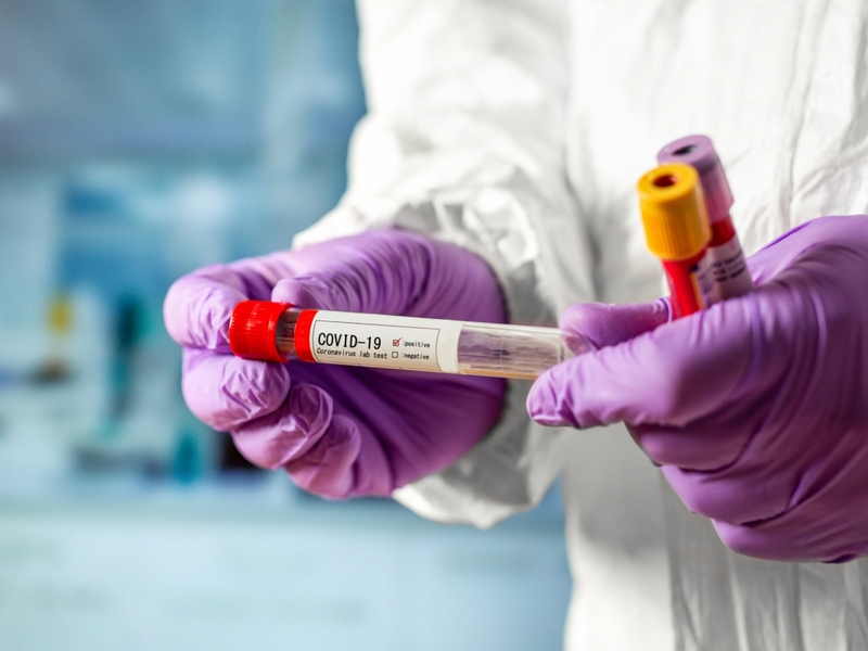 За прошедшие сутки подтверждено 275 случаев коронавируса